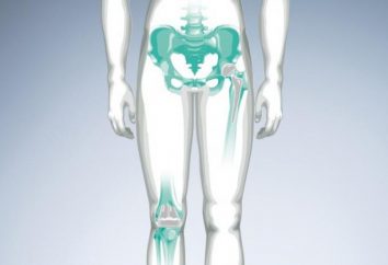 Cliquez sur l'articulation de la hanche: possible prichinyi traitement particulier
