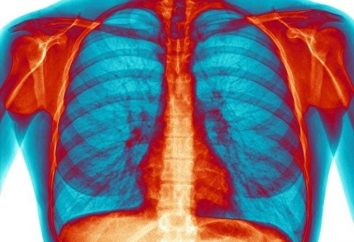 Inhalación bronquitis: no sólo es posible sino necesario!