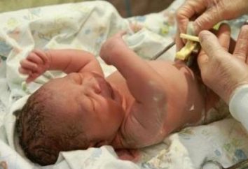 Cómo manejar un ombligo del recién nacido después del alta del hospital?