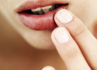 Cause e trattamento delle fessure negli angoli delle labbra