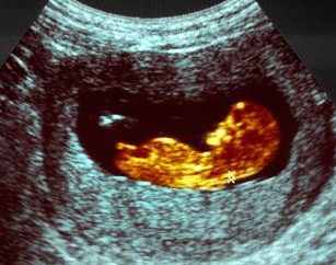 Fetometria del feto per settimane. Dimensione fetale per settimane