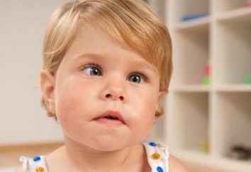 Occluders dzieci do leczenia zeza: opis, terapia charakterystyka