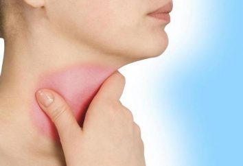 Granulozny zapalenie gardła: leczenie, przyczyny, objawy. Leczenie granuloznogo środków gardła ludowe