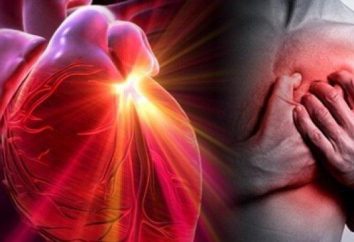 Prevenção de ataque cardíaco: preparações e conselhos de Dr.