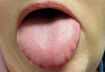 Lo que hace que las impresiones de los dientes en la lengua?