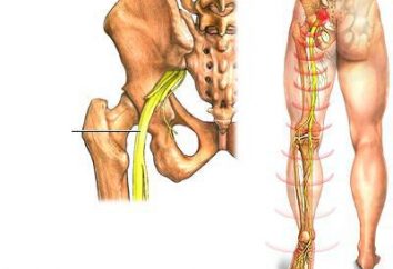 dolor de cadera, se irradia a la pierna. El dolor en la articulación de la cadera: causas, tratamiento