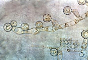 Fungus na virilha nos homens: causas, sintomas e tratamento