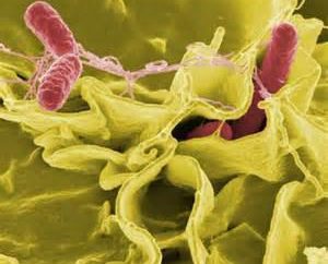 Salmonella – che cos'è? Salmonellosi: sintomi, il trattamento
