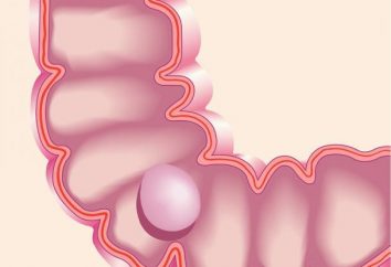 Pólipo en el intestino: síntomas y el tratamiento, la cirugía para eliminar