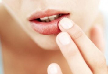 Qu'est-ce que la lèvre gratouille? Signification des marques