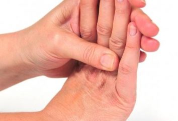 Numb main: causes et un traitement approprié