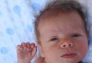 I sintomi e trattamento di torcicollo in un neonato