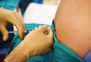 La anestesia epidural para la cesárea: indicaciones y ventajas