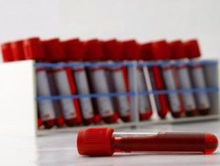 Um exame de sangue em uma criança: transcrição – é possível fazê-lo sozinho?