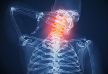 Heilgymnastik in Osteochondrose der Halswirbelsäule: ein Foto, Übungen