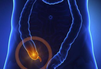 L'inflammation de l'appendice: une description des symptômes, les causes et les caractéristiques du traitement