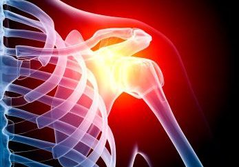 Entorse de articulação do ombro: sintomas e tratamento