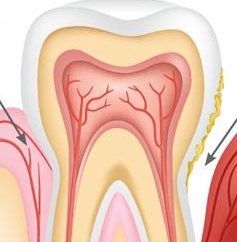 Os sintomas da doença periodontal, diagnóstico e tratamento
