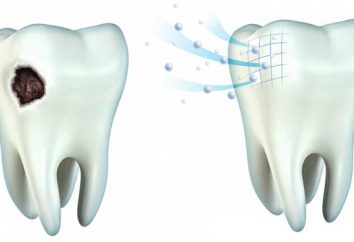 remineralización de los dientes en casa: medicamentos