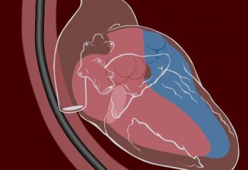échocardiographie transoesophagienne: quel est-il?