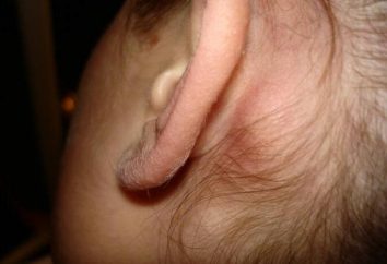 Warum vergrößerte Lymphknoten hinter dem Ohr