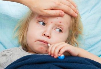 El sarampión es un niño: síntomas y tratamiento