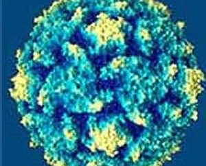 Die gefährlichere Angina Herpes in das Kind und wie man sie bekämpfen