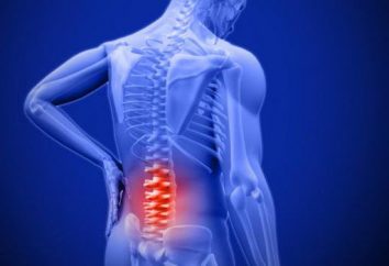 El dolor de espalda da en la pierna derecha: Causas y Tratamientos