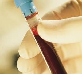 Weiße Blutkörperchen im Urin des Kindes erhöht, oder die ersten Anzeichen einer Infektion