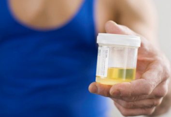 sortie d'urine – quel est-il? Les symptômes et traitement