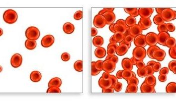 suplementos de hierro para la anemia: pros y contras